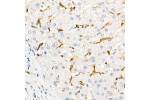 Immunohistochemistry of paraffin-embedded Human liver using Fascin/FSCN1 antibody (ABIN7267142) at dilution of 1:100 (40x lens). (Fascin 抗体)