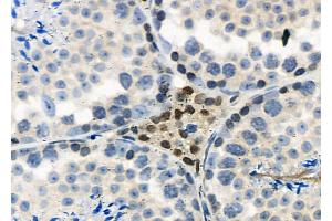 ABIN6265840 and ABIN6277615 at 1/100 staining Mouse testis tissue by IHC-P.