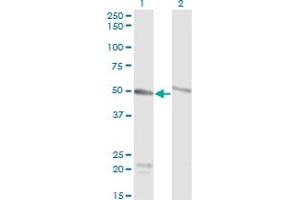 Western Blot analysis of TUBA1C expression in transfected 293T cell line by TUBA6 monoclonal antibody (M01), clone 1D2-H5. (TUBA1C 抗体  (AA 1-449))