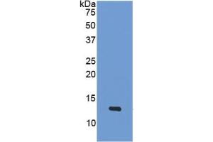 WB of Protein Standard: different control antibodies  against Highly purified E. (PF4 ELISA 试剂盒)