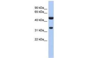 Image no. 1 for anti-Sulfotransferase Family 1B Member 1 (SULT1B1) (AA 71-120) antibody (ABIN6743489) (SULT1B1 抗体  (AA 71-120))