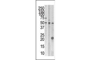 The anti- STYK1 Pab (ABIN392121 and ABIN2837982) is used in Western blot to detect STYK1 in 293 , CEM (center), and mouse kidney cell line/tissue lysates. (STYK1 抗体  (N-Term))
