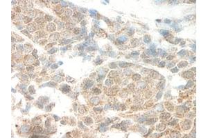 Image no. 5 for anti-Leptin (LEP) antibody (ABIN465530) (Leptin 抗体)