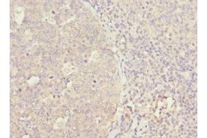 Immunohistochemistry (IHC) image for anti-Wingless-Type MMTV Integration Site Family, Member 5B (WNT5B) (AA 120-359) antibody (ABIN7166308)