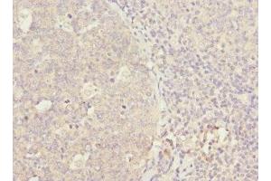Immunohistochemistry of paraffin-embedded human tonsil tissue using ABIN7166308 at dilution of 1:100