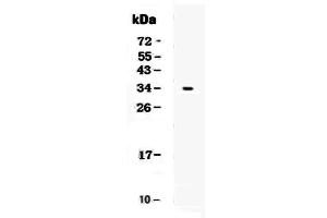 Western blot analysis of CD7 using anti-CD7 antibody . (CD7 抗体  (AA 26-172))