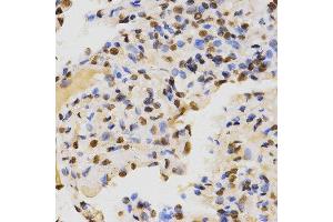 Immunohistochemistry (IHC) image for anti-Histone 3 (H3) (H3K36me2) antibody (ABIN3016036)