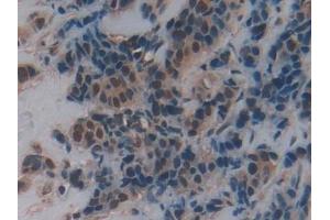 Immunohistochemistry (IHC) image for anti-Frizzled Family Receptor 1 (Fzd1) (AA 117-322) antibody (ABIN7435805)