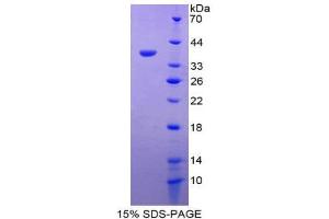 SDS-PAGE (SDS) image for Metallothionein 1 (MT1) (AA 1-61) protein (His tag,GST tag) (ABIN2123266) (MT1 Protein (AA 1-61) (His tag,GST tag))