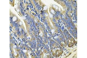 Immunohistochemistry of paraffin-embedded Mouse intestine using EIF3C Polyclonal Antibody at dilution of 1:100 (40x lens). (EIF3C 抗体)
