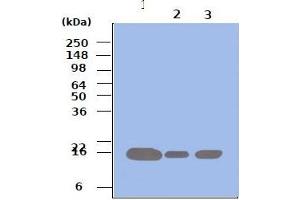 Western blot analysis: Lane 1 : 293T Lane 2 : HeLa Lane 3 : Jurkat Cell lysates of 293T, HeLa and Jurkat (each 50ug) were resolved by SDS-PAGE, transferred to PVDF membrane and probed with anti-human Pin1 (1:500). (PIN1 抗体)