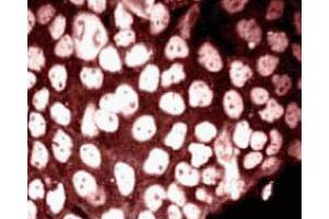 Immunofluorescence staining of phosphoserine (clone 19, MN ABIN968871) on A431 cells (Human epithelial carcinoma, ATCC CRL-1555) treated with 10 nM calyculin A and 500 nM okadaic acid. (Phosphoserine/Threonine 抗体)