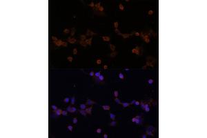 Immunofluorescence analysis of NIH-3T3 cells using UBE2L3 Polyclonal Antibody (ABIN1683196, ABIN3018653, ABIN3018655 and ABIN6220527) at dilution of 1:100 (40x lens). (UBE2L3 抗体  (AA 73-212))