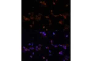 Immunofluorescence analysis of NIH-3T3 cells using UBE2L3 Polyclonal Antibody (ABIN1683196, ABIN3018653, ABIN3018655 and ABIN6220527) at dilution of 1:100 (40x lens). (UBE2L3 抗体  (AA 73-212))
