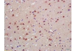 Formalin-fixed and paraffin embedded rat brain labeled with Anti-SATB2 Polyclonal Antibody, Unconjugated (ABIN1385735) at 1:200, followed by conjugation to the secondary antibody and DAB staining (SATB2 抗体  (AA 451-485))