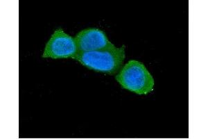 IF analysis of Caspase-3 using anti-Caspase-3 antibody (ABIN6719555).