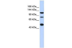 WB Suggested Anti-ZEB2 Antibody Titration:  0. (ZEB2 抗体  (Middle Region))