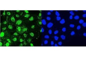 IF analysis of Hsp105 using anti-Hsp105 antibody (ABIN5693036). (HSPH1 抗体  (AA 653-858))