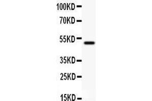 Anti- CD80 antibody,  Western blotting All lanes: Anti CD80 () at 0. (CD80 抗体  (N-Term))