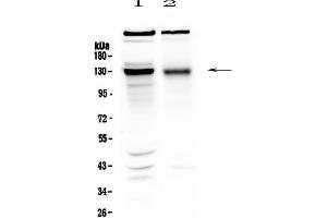 Western blot analysis of BMPR2 using anti-BMPR2 antibody . (BMPR2 抗体  (AA 455-512))