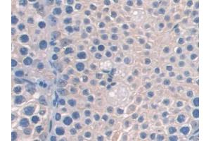 DAB staining on IHC-P; Samples: Mouse Testis Tissue (AASS 抗体  (AA 477-926))