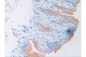 Figure. (ATF6 抗体  (AA 1-377))