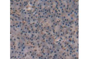 IHC-P analysis of Human Tissue, with DAB staining. (NR5A2 + LRH1 抗体  (AA 300-541))