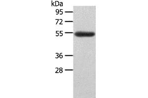 Western Blotting (WB) image for anti-Lymphocyte-Activation Gene 3 (LAG3) antibody (ABIN2431574) (LAG3 抗体)