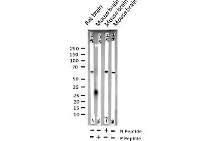 Western blot analysis of Phospho-p62 Dok (Tyr398) expression in various lysates