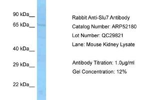 Western Blotting (WB) image for anti-SLU7 Splicing Factor Homolog (SLU7) (Middle Region) antibody (ABIN2774006) (SLU7 抗体  (Middle Region))