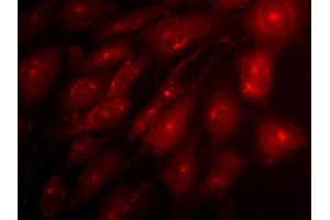 Indirect immunofluorescence on 3T3 cells (dilution 1 : 500) in combination with a Cy3 labeled secondary antibody (dilution 1 : 500). (Syntaxin 12/13 (AA 1-250) 抗体)