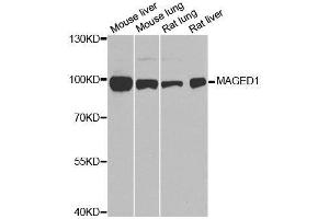 Western Blotting (WB) image for anti-Melanoma Antigen Family D, 1 (MAGED1) (AA 635-834) antibody (ABIN3021415)