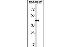 Western blot analysis in MDA-MB435 cell line lysates (35ug/lane). (MAP2K5 抗体  (C-Term))