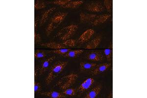 Immunofluorescence analysis of H9C2 cells using NDUF Rabbit pAb (ABIN6132401, ABIN6144467, ABIN6144468 and ABIN6215694) at dilution of 1:100 (40x lens). (NDUFA8 抗体  (AA 33-172))