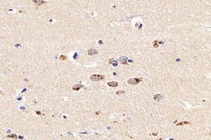 Immunohistochemistry analysis of paraffin-embedded human brain using,PSMD8 (ABIN7075226) at dilution of 1: 2600 (PSMD8 抗体)