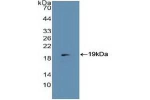 Detection of Recombinant MCP, Human using Polyclonal Antibody to Membrane Cofactor Protein (MCP)
