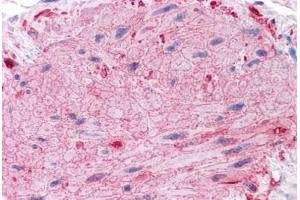 Human Skin, Arrector Pili: Formalin-Fixed, Paraffin-Embedded (FFPE) (Vinculin 抗体  (AA 452-701))