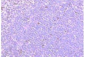 Immunohistochemistry on paraffin section of human spleen (CCRD6 (Extracellular Domain), (N-Term) 抗体)