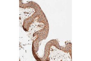 Immunohistochemical analysis of paraffin-embedded human skin tissue using C performed on the Leica® BOND RXm.