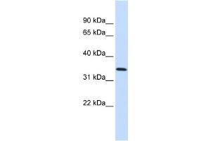 WB Suggested Anti-ANXA4 Antibody Titration:  0. (Annexin IV 抗体  (Middle Region))