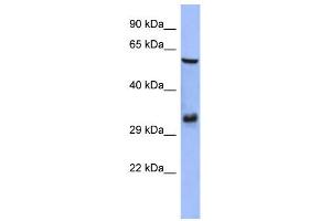 WB Suggested Anti-FOSL1 Antibody Titration:  0. (FOSL1 抗体  (Middle Region))