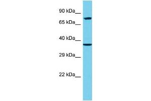 Host: Rabbit Target Name: EPN3 Sample Type: 293T Whole Cell lysates Antibody Dilution: 1. (EPN3 抗体  (C-Term))