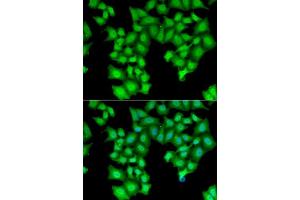 Immunofluorescence analysis of HeLa cells using CPSF3L antibody. (CPSF3L 抗体  (AA 331-600))