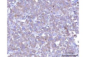 IHC analysis of RPS25 using anti-RPS25 antibody (ABIN7601567).