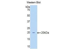 Western Blotting (WB) image for anti-Hexosaminidase B (Beta Polypeptide) (HEXB) (AA 294-435) antibody (ABIN1859138) (HEXB 抗体  (AA 294-435))