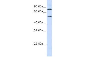 Western Blotting (WB) image for anti-Solute Carrier Family 27 (Fatty Acid Transporter), Member 4 (SLC27A4) antibody (ABIN2458790) (SLC27A4 抗体)