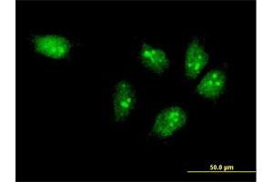 Immunofluorescence of monoclonal antibody to MTA3 on HeLa cell. (MTA3 抗体  (AA 416-515))