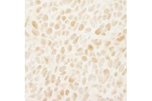 Immunohistochemistry (IHC) image for anti-Leo1, Paf1/RNA Polymerase II Complex Component, Homolog (S. Cerevisiae) (LEO1) (AA 550-600) antibody (ABIN7448630)