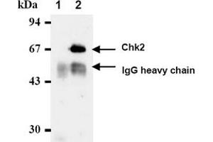 Western Blotting (WB) image for anti-Checkpoint Kinase 2 (CHEK2) antibody (ABIN487312) (CHEK2 抗体)