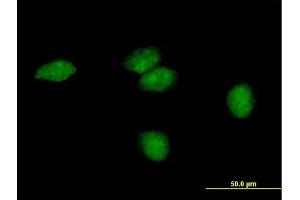 Immunofluorescence of purified MaxPab antibody to FLJ35220 on HeLa cell. (Endonuclease V 抗体  (AA 1-264))